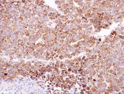 Immunohistochemistry-Paraffin: CLPP Antibody [NBP1-31011]