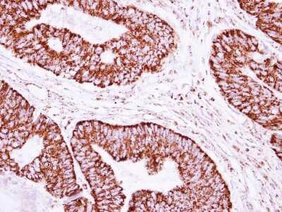 Immunohistochemistry-Paraffin: CLPP Antibody [NBP2-15919]