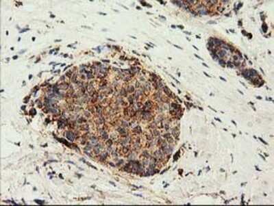 Immunohistochemistry: CLPP Antibody (OTI1F6) - Azide and BSA Free [NBP2-71363]