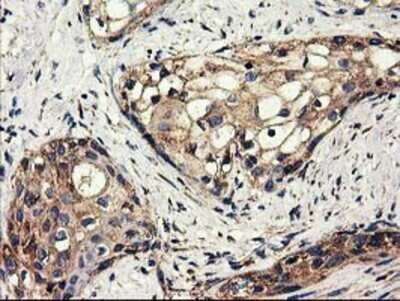 Immunohistochemistry: CLPP Antibody (OTI1F6) - Azide and BSA Free [NBP2-71363]