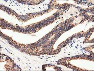 Immunohistochemistry: CLPP Antibody (OTI1F6) - Azide and BSA Free [NBP2-71363]
