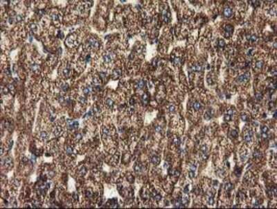 Immunohistochemistry: CLPP Antibody (OTI1F6) - Azide and BSA Free [NBP2-71363]