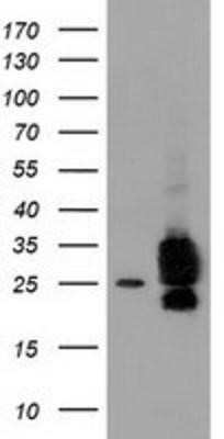 Western Blot: CLPP Antibody (OTI1F6)Azide and BSA Free [NBP2-71363]