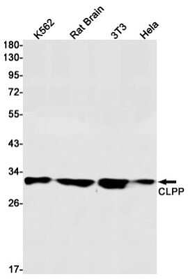 Western Blot: CLPP Antibody (S02-1E5) [NBP3-15014]