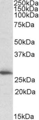 Western Blot: CLPP Antibody [NB100-1189]