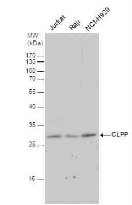 Western Blot: CLPP Antibody [NBP1-31011]