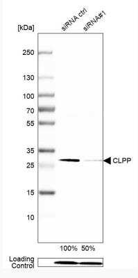 Western Blot: CLPP Antibody [NBP1-89557]