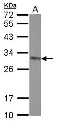 Western Blot: CLPP Antibody [NBP2-15919]