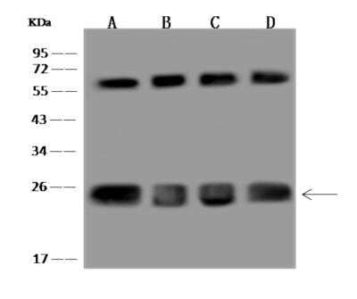 Western Blot: CLPP Antibody [NBP3-06239]