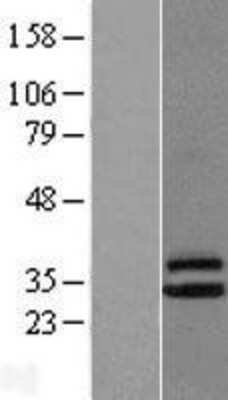 Western Blot: CLPP Overexpression Lysate [NBL1-09279]