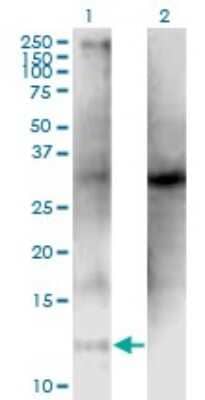 Western Blot: CLPS Antibody (4G3) [H00001208-M05]