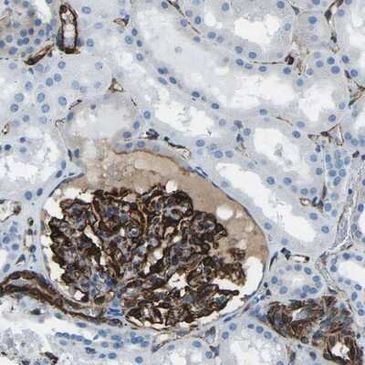Immunohistochemistry-Paraffin: CLPS Antibody [NBP1-86109]