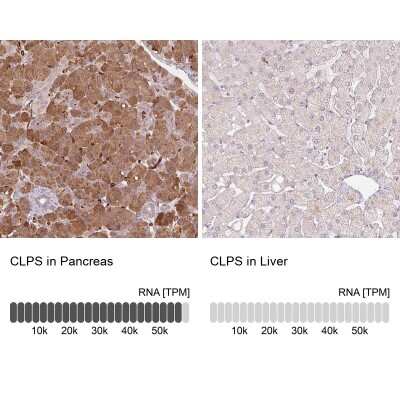 Immunohistochemistry-Paraffin: CLPS Antibody [NBP1-86109]