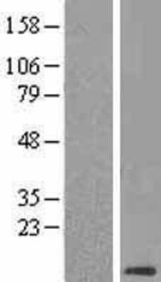 Western Blot: CLPS Overexpression Lysate [NBL1-09280]