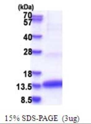 SDS-PAGE: Recombinant Human CLPS His Protein [NBP2-51686]