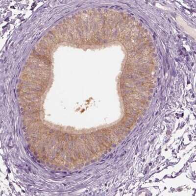 Immunohistochemistry-Paraffin: CLPSL1 Antibody [NBP2-57787]