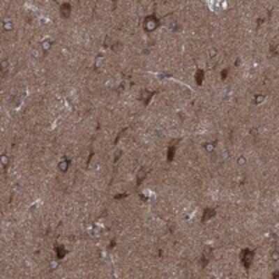 Immunohistochemistry-Paraffin: CLPTM1 Antibody [NBP3-17231]