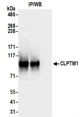 Western Blot: CLPTM1 Antibody [NBP2-32114]