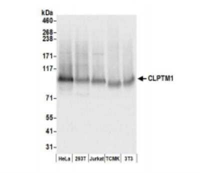 Western Blot: CLPTM1 Antibody [NBP2-32114]