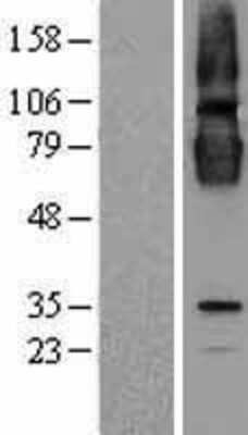 Western Blot: CLPTM1 Overexpression Lysate [NBL1-09281]