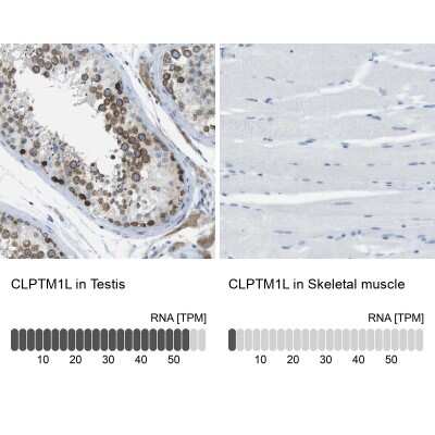 Immunohistochemistry-Paraffin: CLPTM1L Antibody [NBP1-84378]