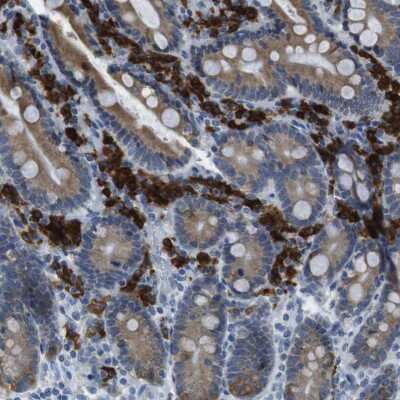 Immunohistochemistry-Paraffin: CLPTM1L Antibody [NBP1-84378]