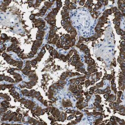 Immunohistochemistry-Paraffin: CLPTM1L Antibody [NBP1-84378]