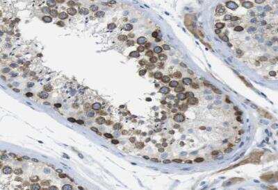 Immunohistochemistry-Paraffin: CLPTM1L Antibody [NBP1-84378]