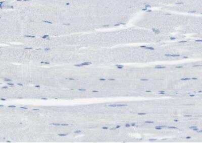 Immunohistochemistry-Paraffin: CLPTM1L Antibody [NBP1-84378]