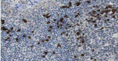 Immunohistochemistry-Paraffin: CLPTM1L Antibody [NBP1-84378]