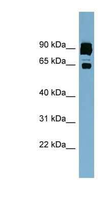 Western Blot: CLPTM1L Antibody [NBP1-62477]