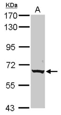 Western Blot: CLPTM1L Antibody [NBP2-15920]