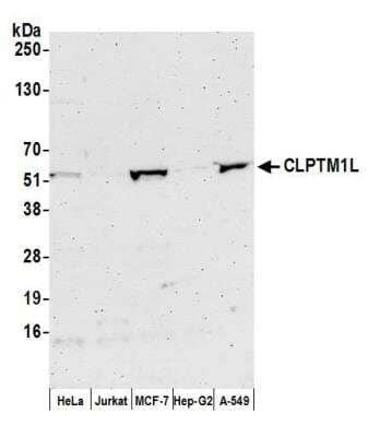 Western Blot: CLPTM1L Antibody [NBP2-76385]