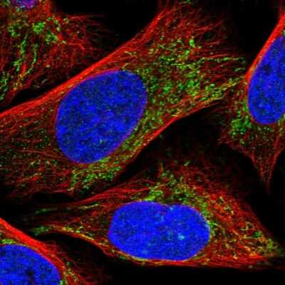 Immunocytochemistry/ Immunofluorescence: CLPX Antibody [NBP1-89478]