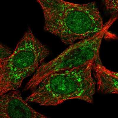 Immunocytochemistry/ Immunofluorescence: CLPX Antibody [NBP2-56426]