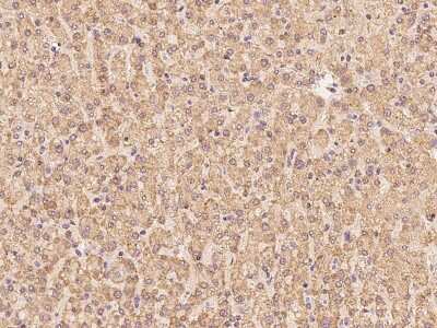 Immunohistochemistry-Paraffin: CLPX Antibody [NBP2-97804]