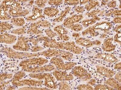 Immunohistochemistry-Paraffin: CLPX Antibody [NBP2-97804]