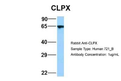 Western Blot: CLPX Antibody [NBP2-84698]