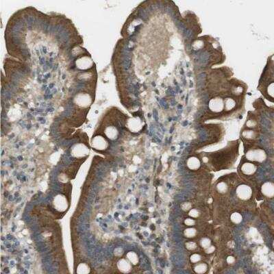 Immunohistochemistry-Paraffin: CLRN3 Antibody [NBP1-81119]