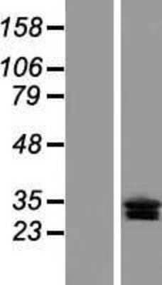 Western Blot: CLRN3 Overexpression Lysate [NBL1-09284]