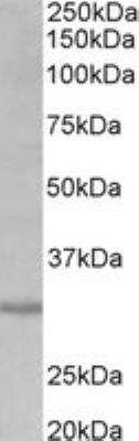 Western Blot: CLS1 Antibody [NBP2-27464]