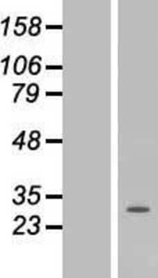 Western Blot: CLS1 Overexpression Lysate [NBP2-06721]