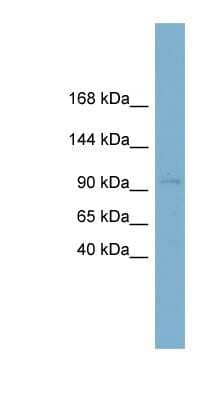 Western Blot: Calsyntenin-1 Antibody [NBP1-59862]