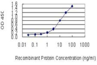 ELISA: CLTB Antibody (4B12-1E3) [H00001212-M01]