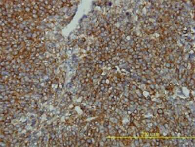 Immunohistochemistry-Paraffin: CLTB Antibody (4B12-1E3) [H00001212-M01]