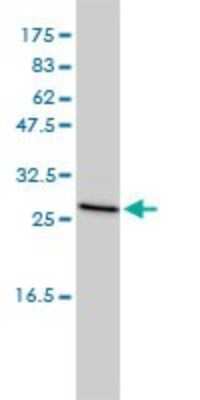 Western Blot: CLTB Antibody (4B12-1E3) [H00001212-M01]