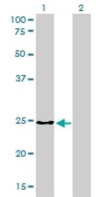 Western Blot: CLTB Antibody (4B12-1E3) [H00001212-M01]