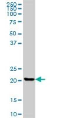 Western Blot: CLTB Antibody [H00001212-B01P]