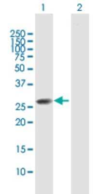 Western Blot: CLTB Antibody [H00001212-B01P]