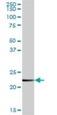 Western Blot: CLTB Antibody [H00001212-D01P]
